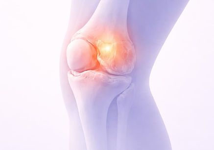 Book a PT evaluation to build a plan that reduces knee arthritis pain and restores strength for the activities you want to keep doing.