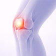 Side view medical illustration of a knee with the kneecap area highlighted in red to represent runner’s knee pain.