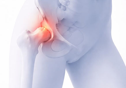 Book a PT evaluation to confirm a labral tear or FAI driver.