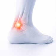 Side view medical illustration of an ankle and foot with the outer ankle highlighted in red to indicate a sprain.