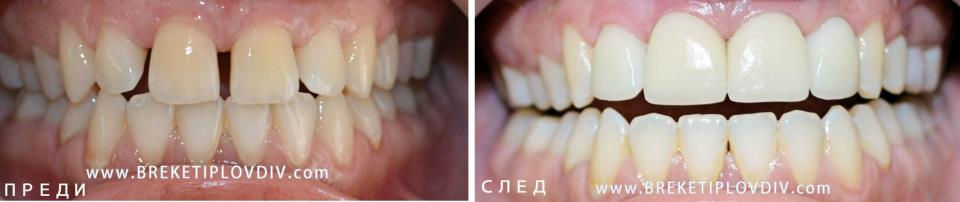 Фасети