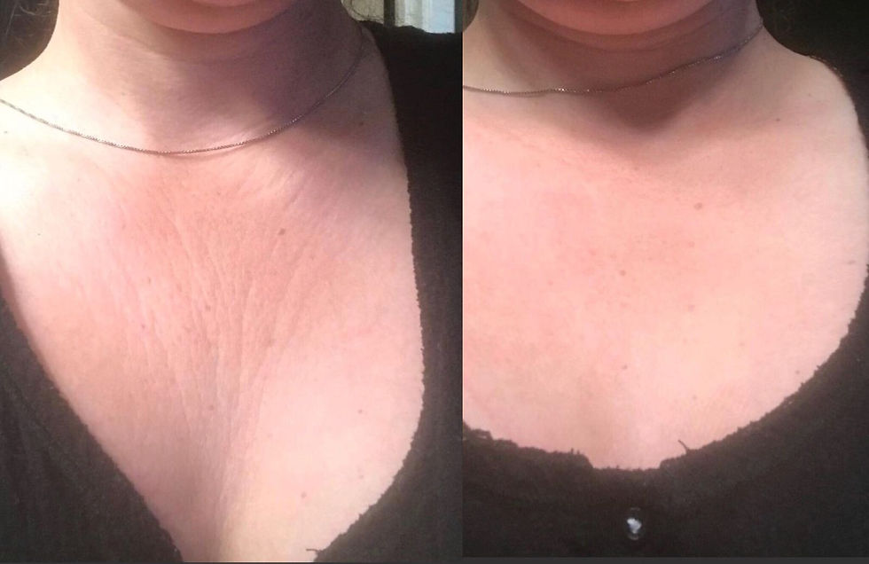 clientbeforeandafterpic