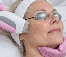 04-photofacial.png