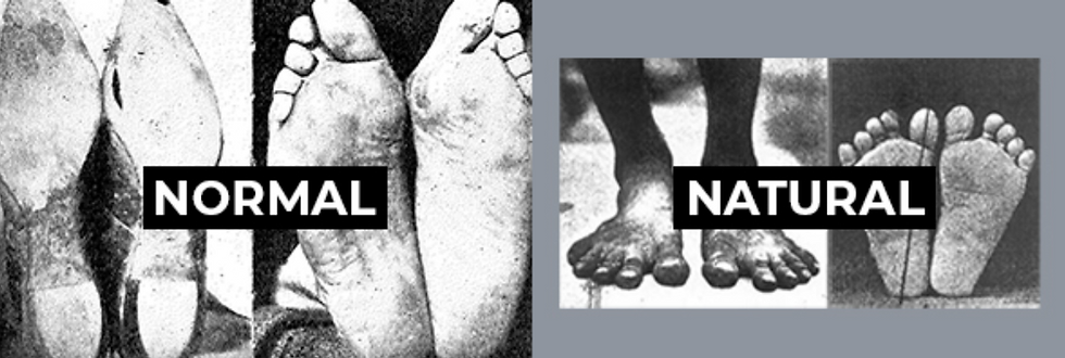 Normal vs natural footwear