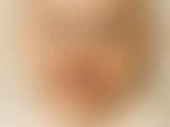 The M-Shaped Palate in Infants: What It Reveals About Growth and Function