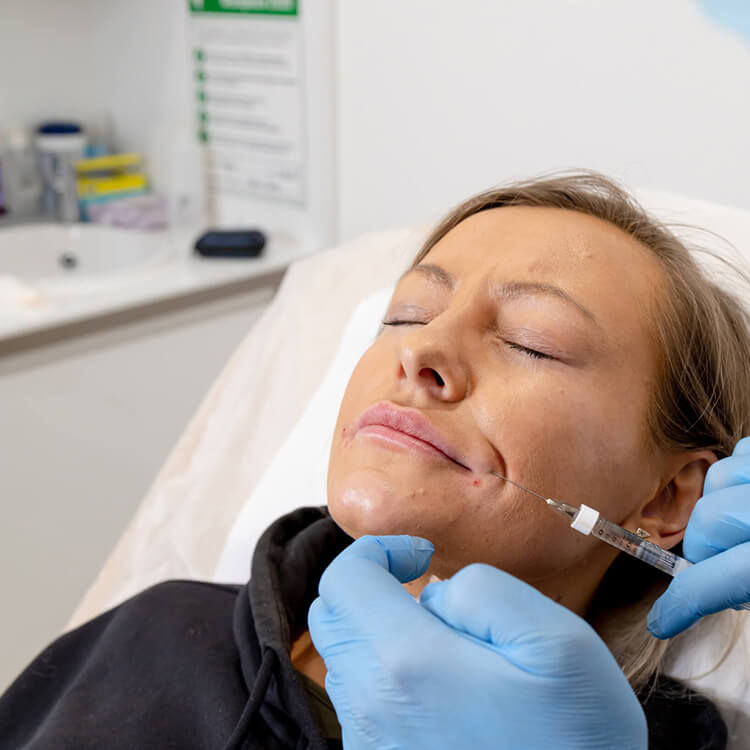 Woman receiving lip filler injections by a professional wearing blue gloves, with the needle applied to the side of the mouth to enhance volume and shape.