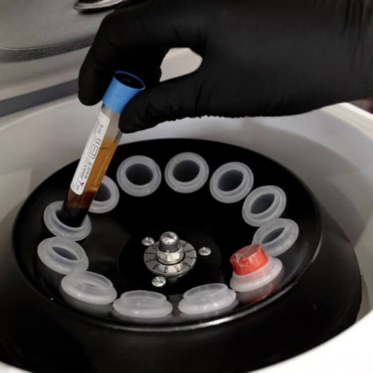 A gloved hand placing a vial of separated blood into a centrifuge for plasma rich facial preparation