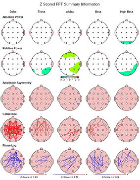 neurofeedback-for-adhd-katy-tx-77494.jpg
