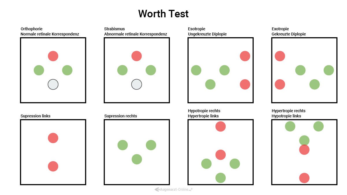 Worth Four Dot Test