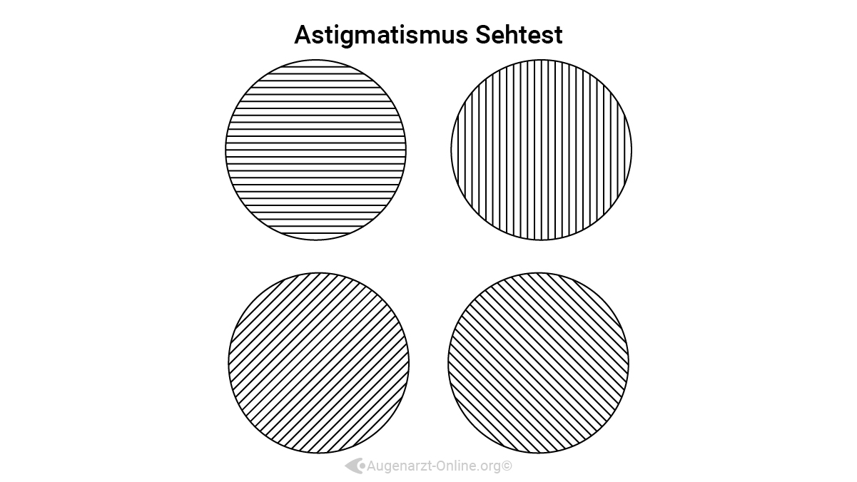 Sehtest zur Bestimmung einer Hornhautverkrümmung oder Stabsichtigkeit.
