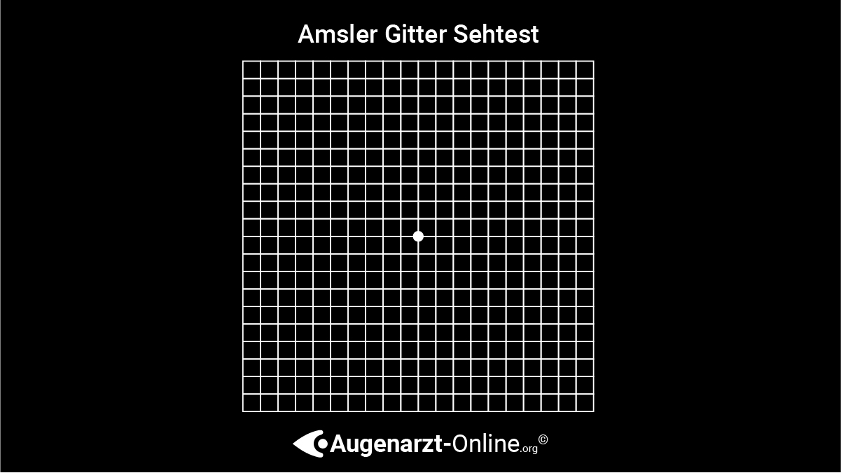 Sehtest zur Bestimmung von Metamorphopsien bei AMD, Makulaödemen, epiretinalen Gliosen, diabetischer Retinopathie, etc.