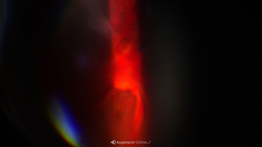 Augenhintergrund Foto eines Hufeisenforamen 