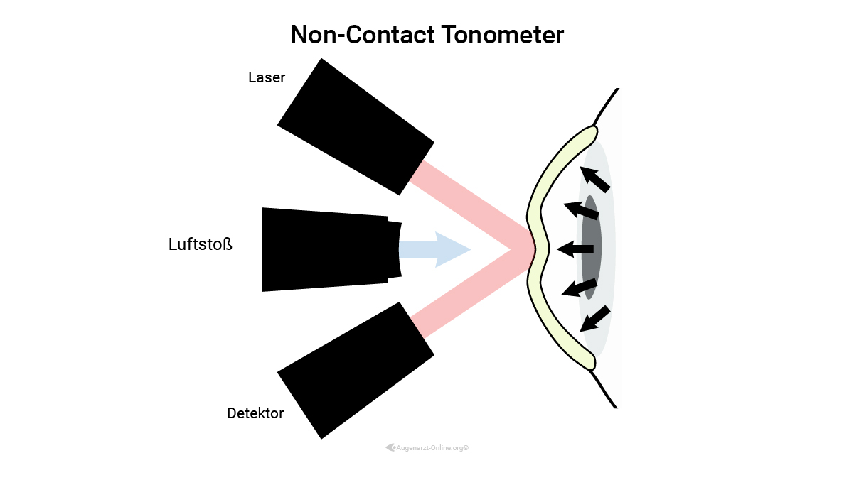 Non-Contact Tonometrie zur Messung des Augendrucks mit Air Puff Methode