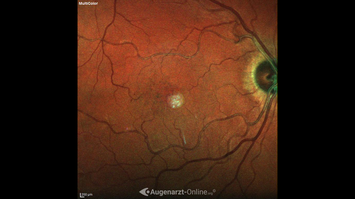 Falschfarbenbild