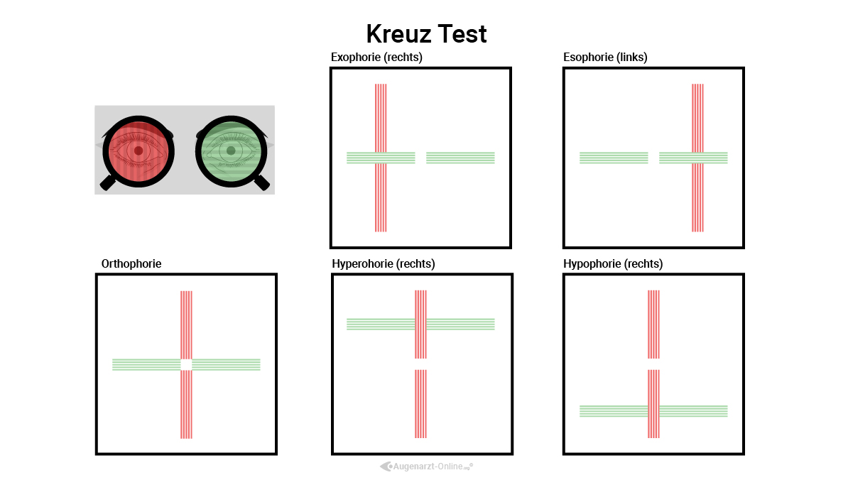 Sehtest mit polarisierten Gläsern und Kreuzfigur