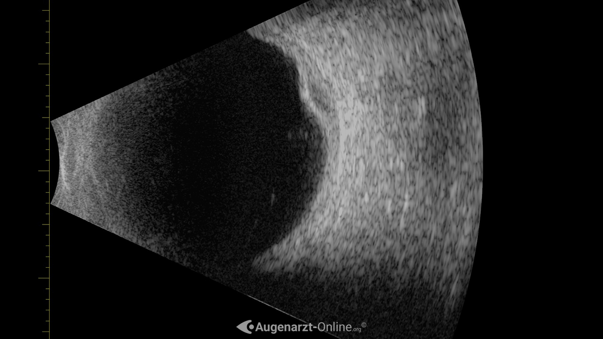 Ultraschall