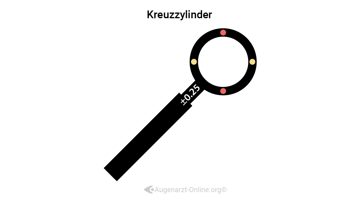 Mit Hilfe eines Kreuzzylinders (Jackson Cross Cylinder) kann die Ausprägung eines Astigmatismus bestimmt werden.
