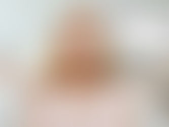 Why it's bad to rub your eyes!