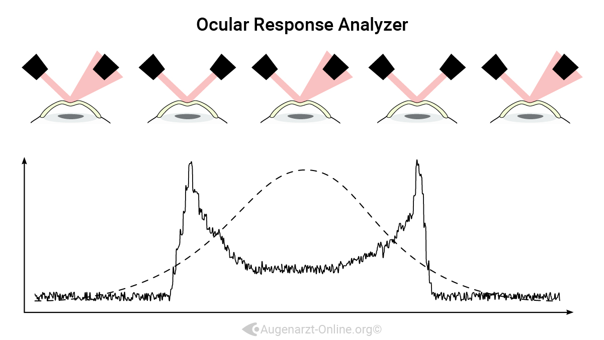 Ocular Response Analyzer Funktionsprinzip Erklärung graphisch veranschaulicht