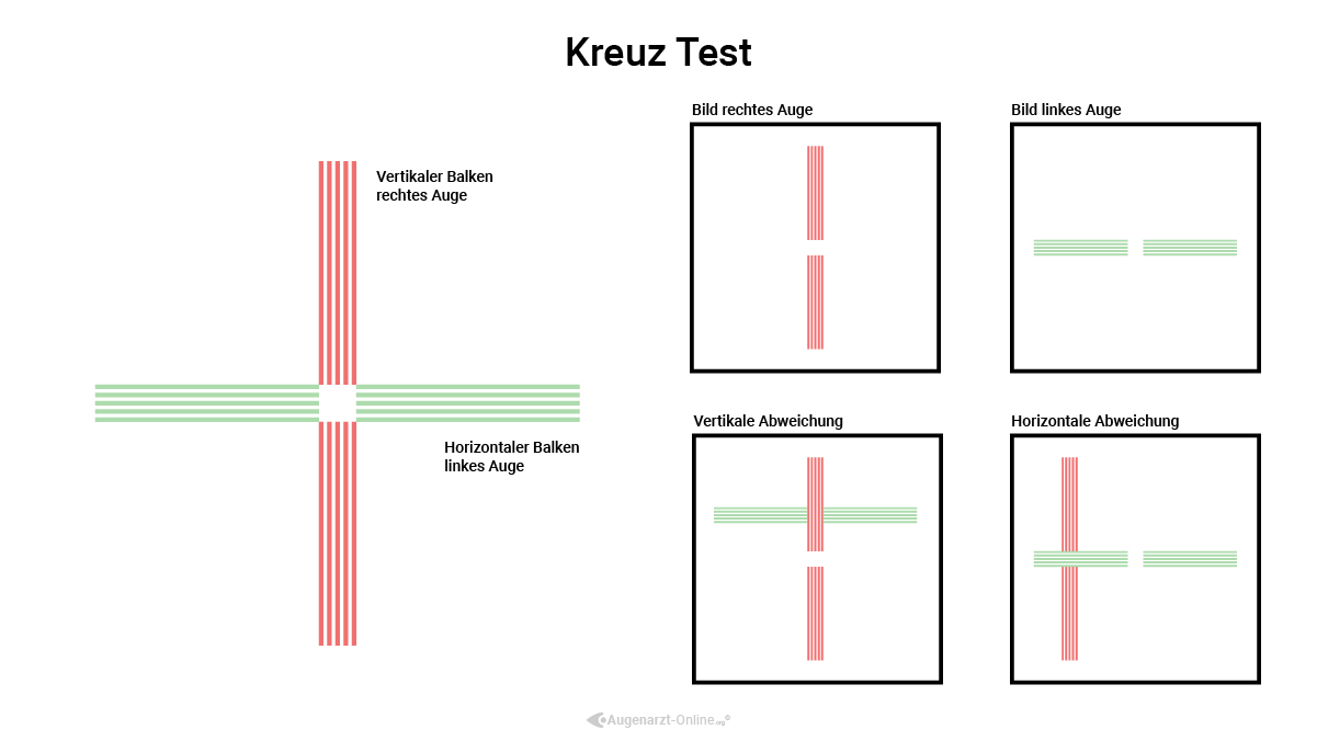 Kreuztest mithilfe polarisierte Gläser inkl Erklärungen zum Sehtest