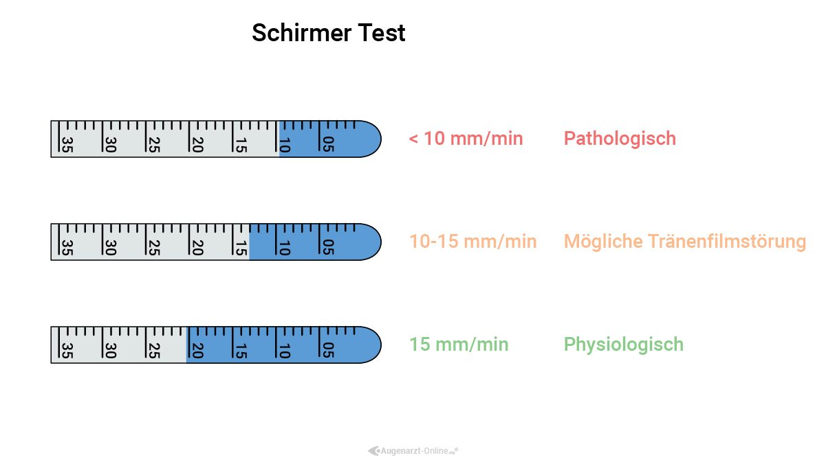 Schirmertest Interpretation und Auswertung