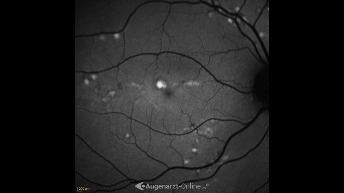 Autofluoreszenz