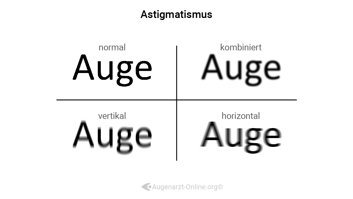 Sehen mit Astigmatismus, Stabsichtigkeit, Hornhautverkrümmung, Beispiel, Erklärung