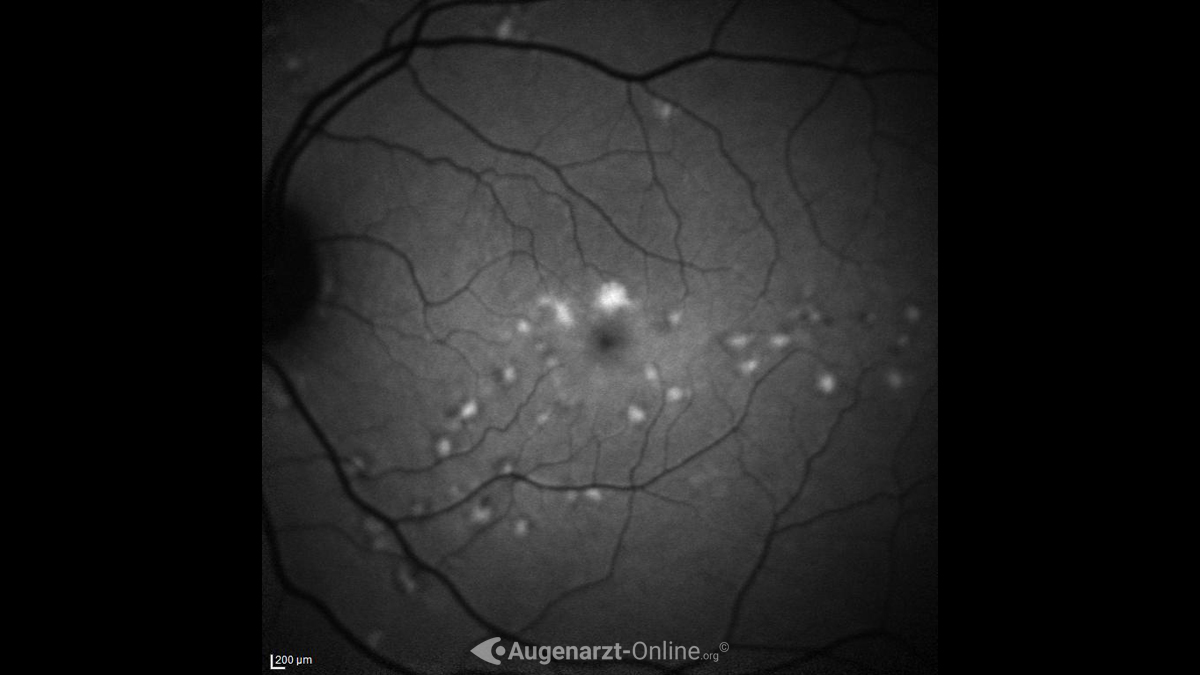Autofluoreszenz