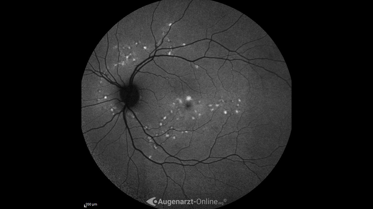 Autofluoreszenz