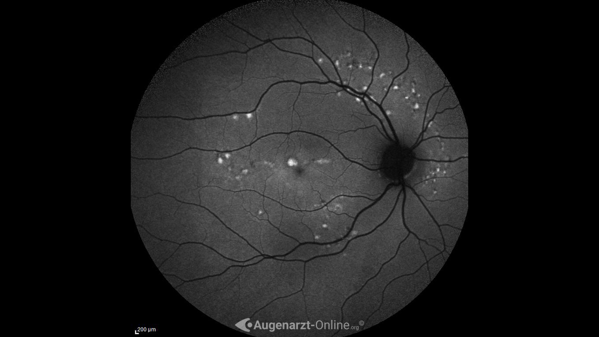 Autofluoreszenz