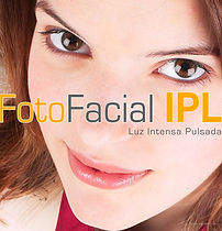 Fotofacial | Dermatologa Dra. Nadia Janette Rodríguez Zendejas | Guadalajara