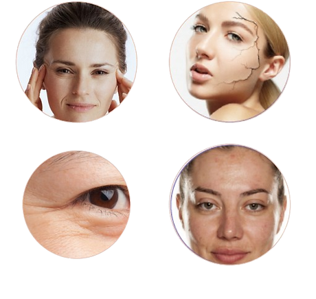 Skin Layer