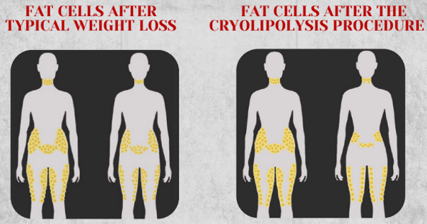 Human Body
