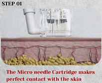 Example Skin Treatment