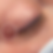 Image of brow tattoo removal by Claire Maree Cosmetic Tattoo Artistry