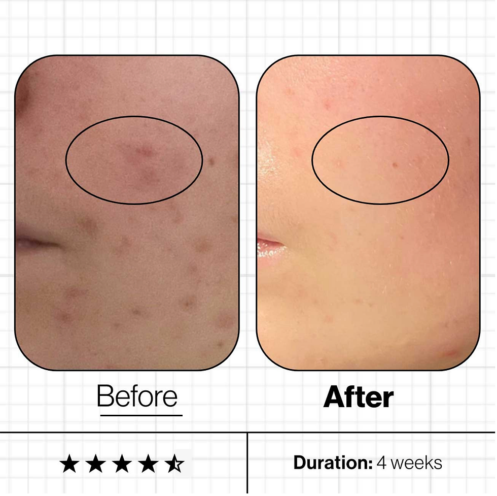 Thumbnail: Skin Clear Biome