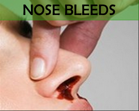 Nose Bleeds