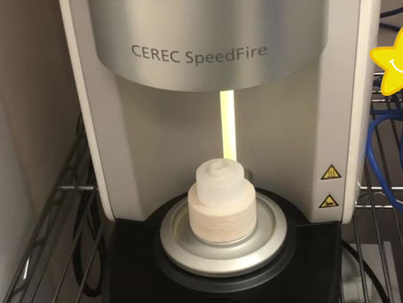 Benefits of a Zirconia Crown