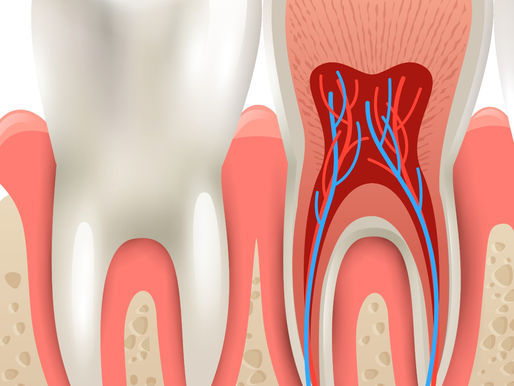 "Why do I have bleeding gums when I brush my teeth?" 😱
