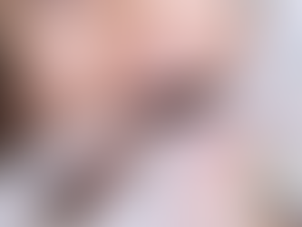 Things to consider before choosing direct-to-consumer ortho kits