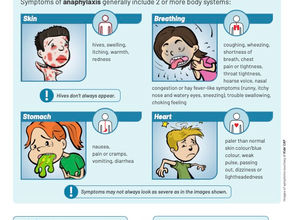 Anaphylaxis in Babies & Young Children