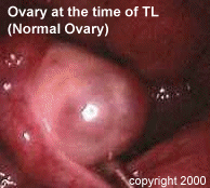 1a Transgressions of Female Sterilization 4.gif