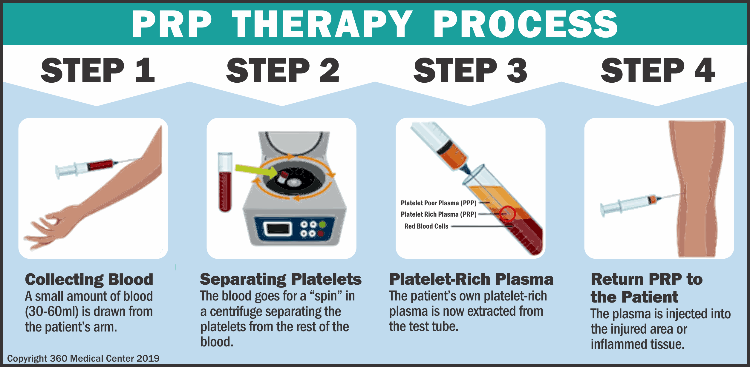 PRP Process.gif