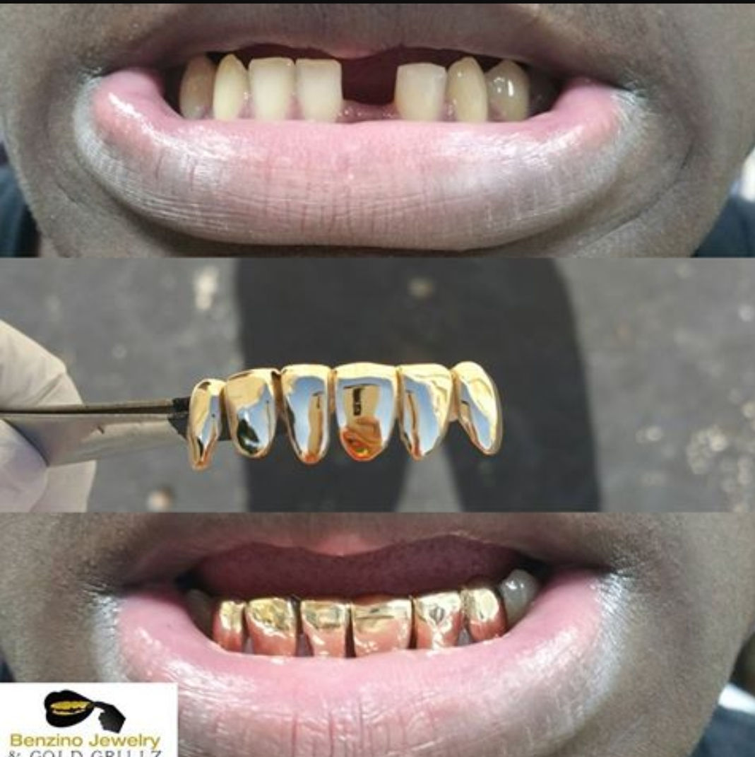 Missing teeth...No problem