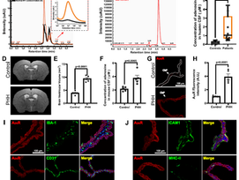 Aberrant adenosine A2A receptor signaling in the choroid plexus drives CSFhypersecretion and ventriculomegaly in hydrocephalus.