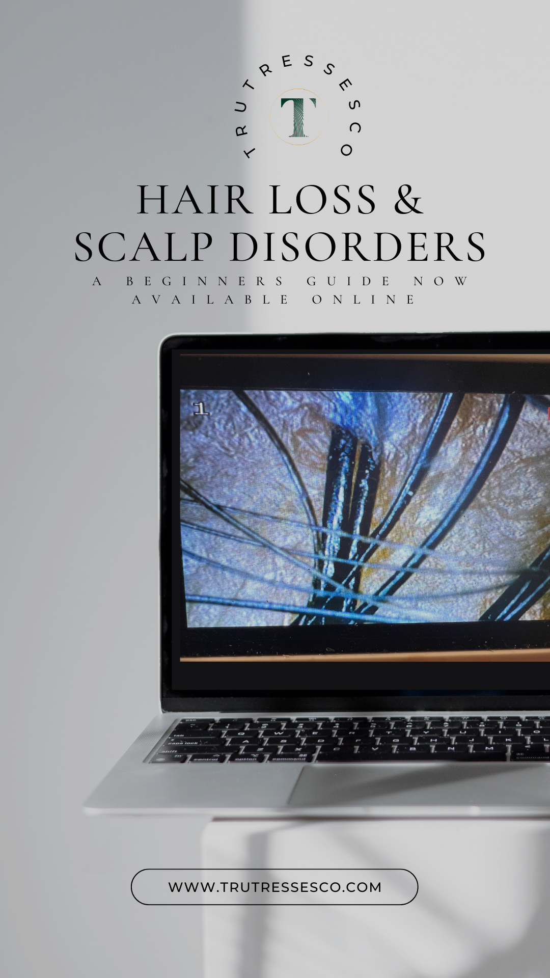 Beginners Guide to Hair Loss & Scalp Disorders