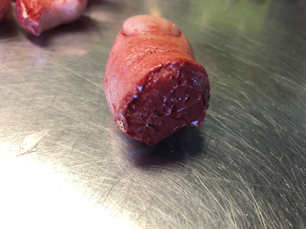 Thumbnail: Severed Big Toe