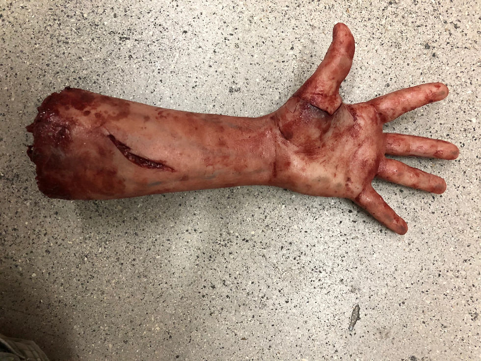 Thumbnail: Severed Arm With Magnetic Thumb