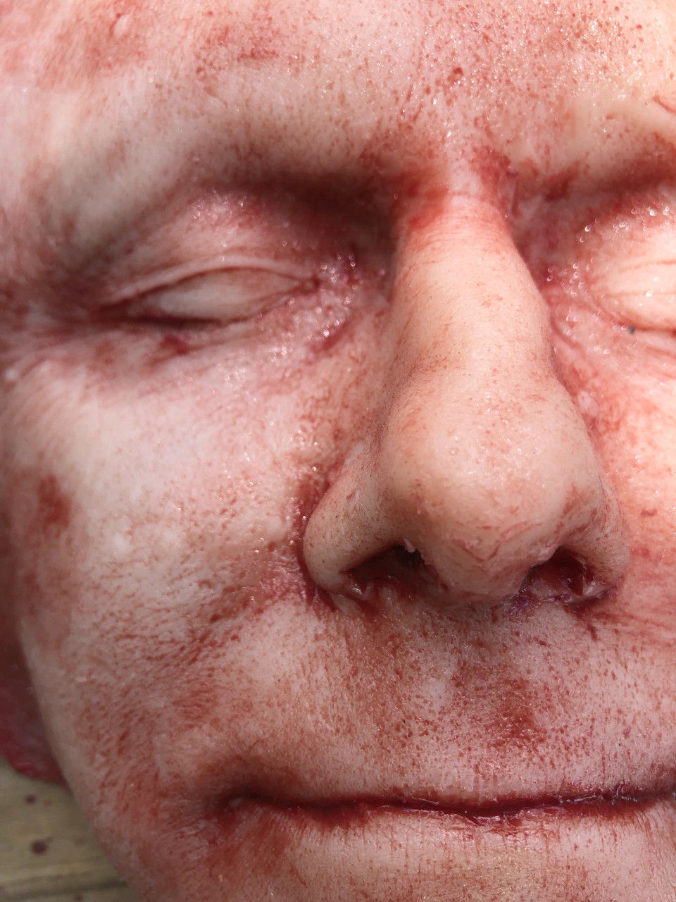 Thumbnail: Skinned Face Middle Aged Male