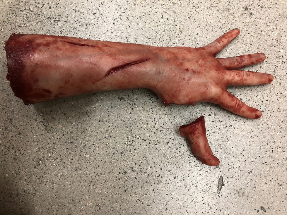 Thumbnail: Severed Arm With Magnetic Thumb